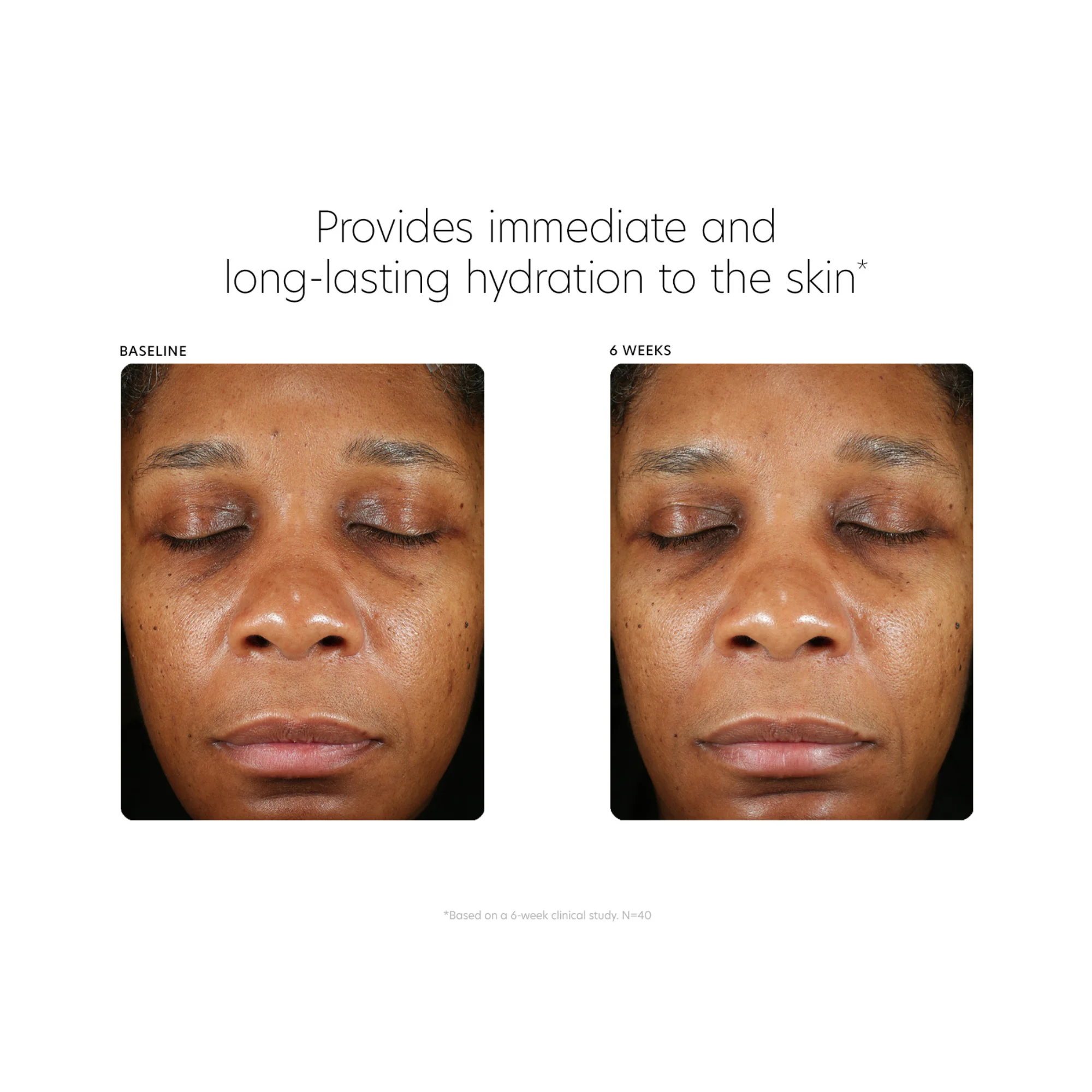 Hyaluronic Acid Boosting Serum - Image 9