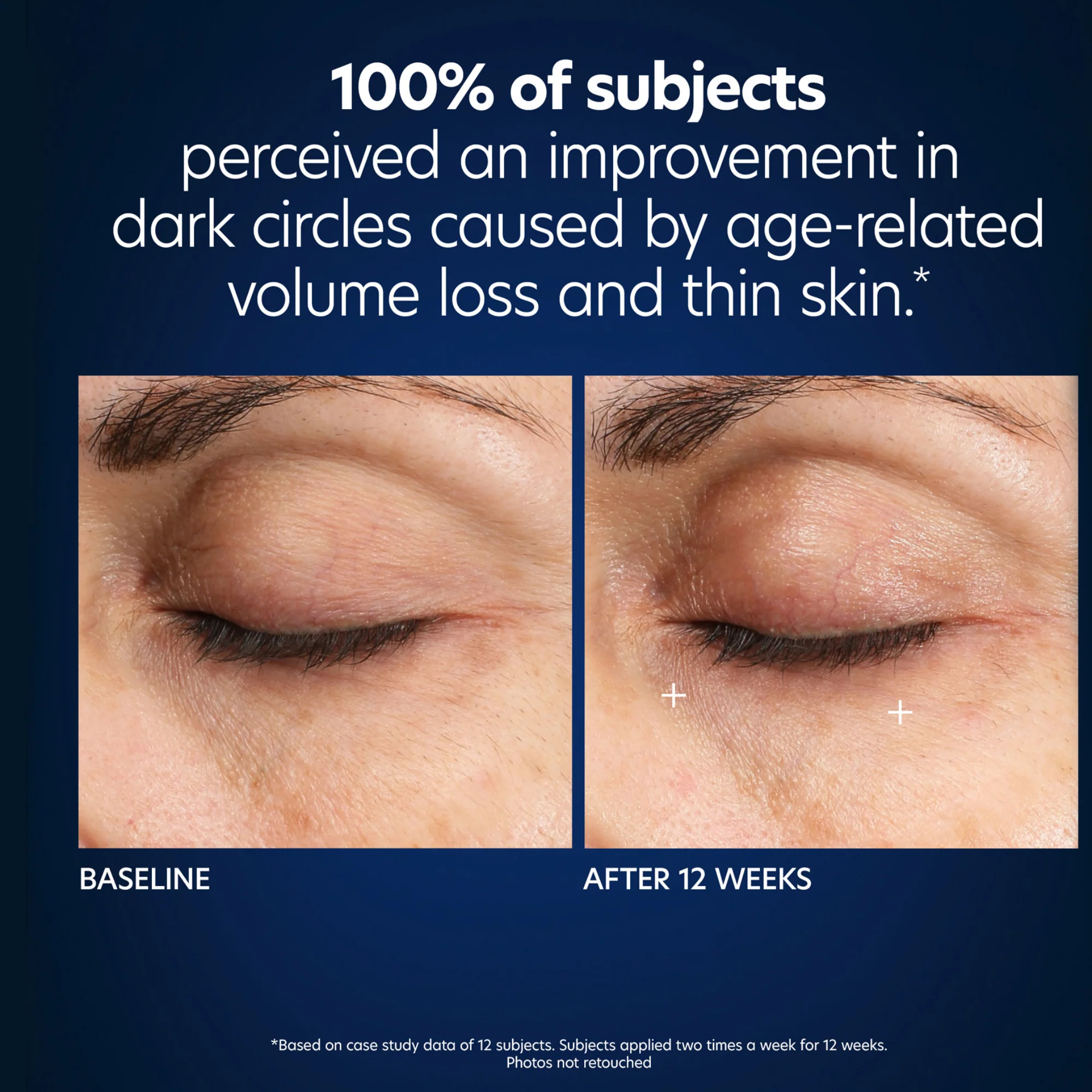 Hyaluronic Acid Microneedle Eye Patches - Image 6