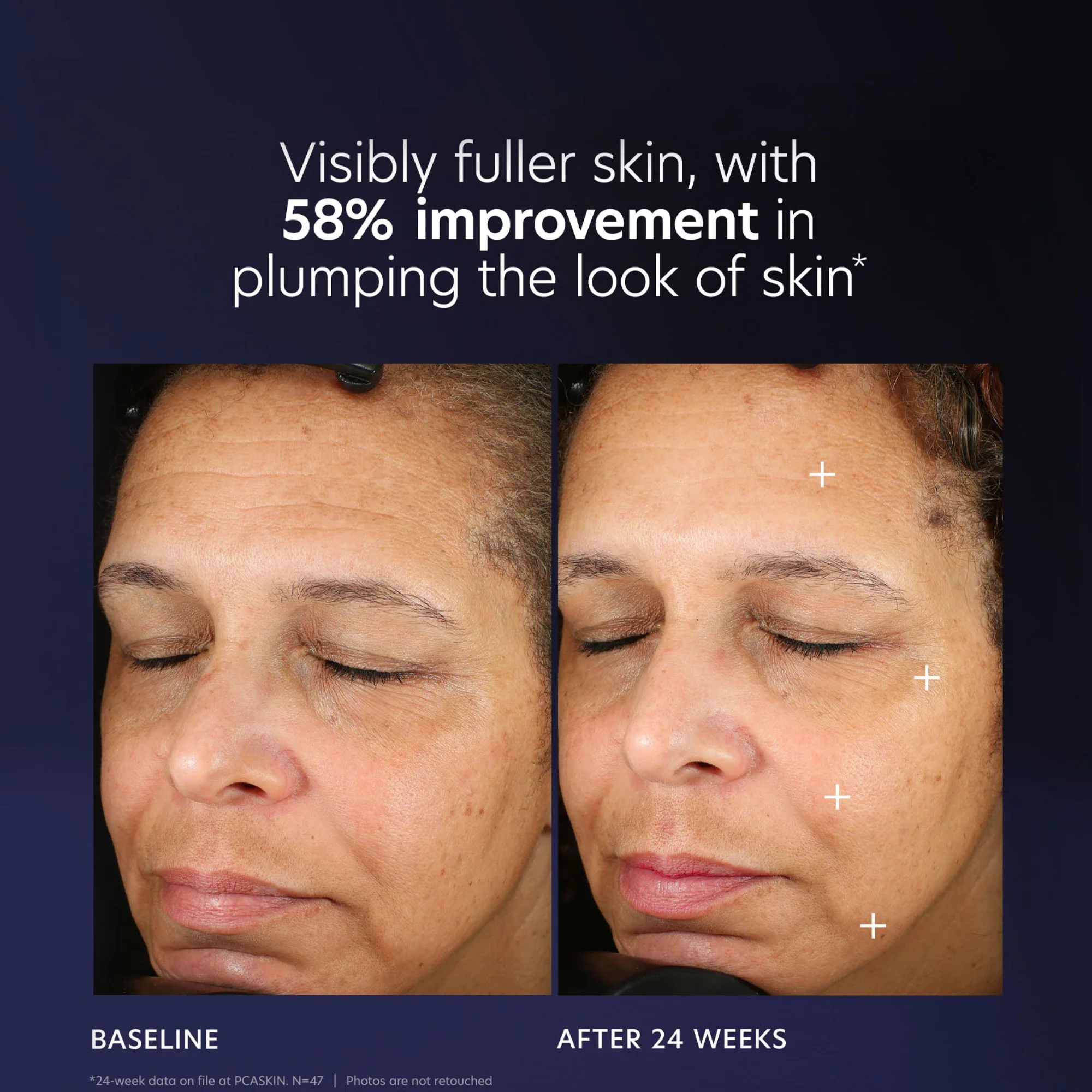 Pro-Max Age Renewal - Image 9