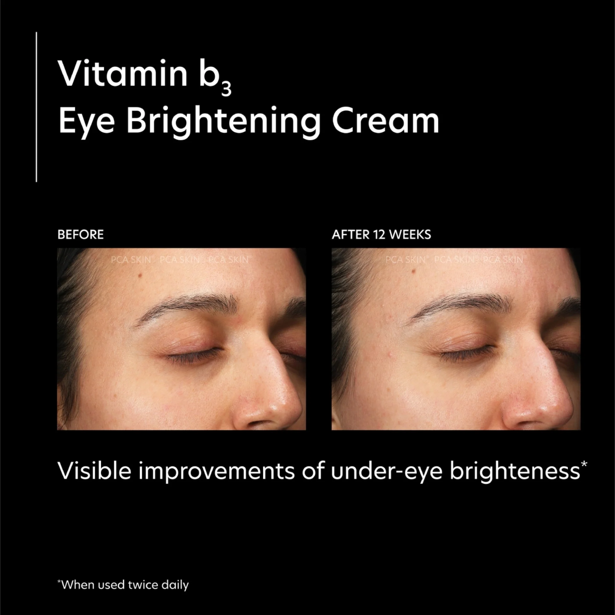 Vitamin b3 Eye Brightening Cream - Image 9